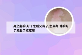 身上起癣,好了之后又有了,怎么办 体癣好了又起了红疙瘩