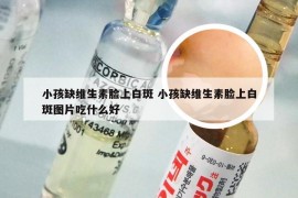 小孩缺维生素脸上白斑 小孩缺维生素脸上白斑图片吃什么好