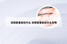 白斑患者应吃什么 白斑患者应吃什么食物