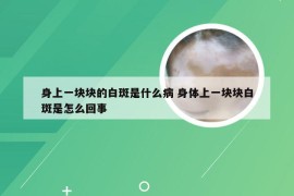 身上一块块的白斑是什么病 身体上一块块白斑是怎么回事