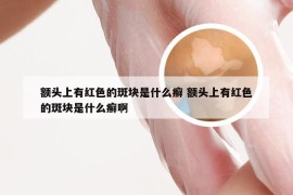 额头上有红色的斑块是什么癣 额头上有红色的斑块是什么癣啊