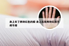 身上长了两块红色的癣 身上出现两块红斑不疼不痒