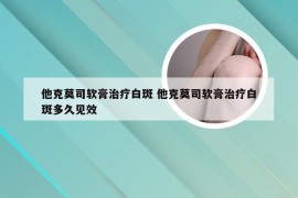 他克莫司软膏治疗白斑 他克莫司软膏治疗白斑多久见效