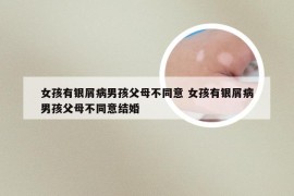 女孩有银屑病男孩父母不同意 女孩有银屑病男孩父母不同意结婚