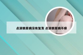 点滴银屑病没有复发 点滴银屑病不痒