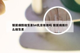 银屑病擦维生素b6乳膏有用吗 银屑病用什么维生素