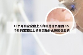 15个月的宝宝脸上长白斑是什么原因 15个月的宝宝脸上长白斑是什么原因引起的