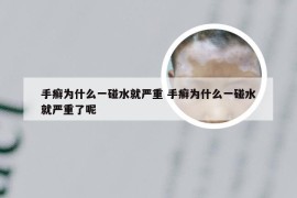 手癣为什么一碰水就严重 手癣为什么一碰水就严重了呢