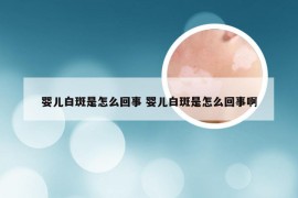 婴儿白斑是怎么回事 婴儿白斑是怎么回事啊