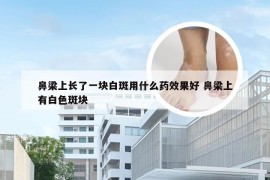 鼻梁上长了一块白斑用什么药效果好 鼻梁上有白色斑块