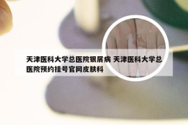 天津医科大学总医院银屑病 天津医科大学总医院预约挂号官网皮肤科