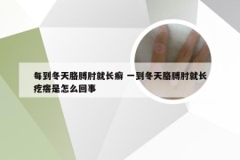 每到冬天胳膊肘就长癣 一到冬天胳膊肘就长疙瘩是怎么回事