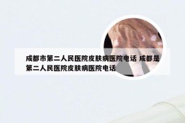 成都市第二人民医院皮肤病医院电话 成都是第二人民医院皮肤病医院电话