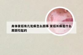 身体背后有几处癣怎么回事 背后长癣是什么原因引起的