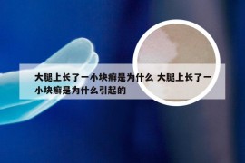 大腿上长了一小块癣是为什么 大腿上长了一小块癣是为什么引起的