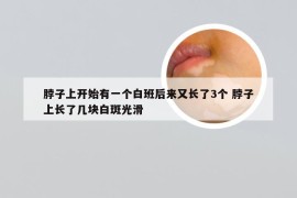 脖子上开始有一个白班后来又长了3个 脖子上长了几块白斑光滑