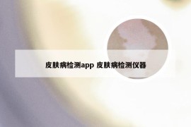 皮肤病检测app 皮肤病检测仪器