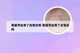 芙丽芳丝用了出现白斑 芙丽芳丝用了会变白吗