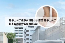 脖子上长了很多白斑是什么原因 脖子上长了很多白斑是什么原因造成的