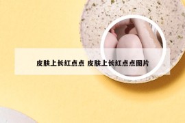 皮肤上长红点点 皮肤上长红点点图片