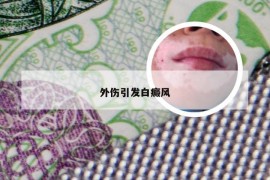 外伤引发白癜风