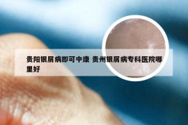 贵阳银屑病即可中康 贵州银屑病专科医院哪里好