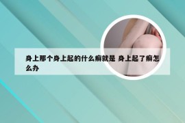 身上那个身上起的什么癣就是 身上起了癣怎么办