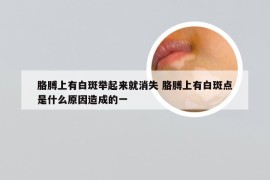 胳膊上有白斑举起来就消失 胳膊上有白斑点是什么原因造成的一