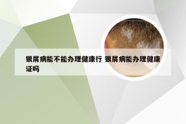 银屑病能不能办理健康行 银屑病能办理健康证吗