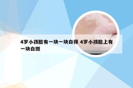 4岁小孩脸有一块一块白得 4岁小孩脸上有一块白斑