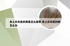 身上长白色的癣是怎么回事 身上长白色的癣怎么办