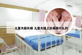 儿童大腿长癣 儿童大腿上长癣用什么药