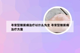 寻常型银屑病治疗以什么为主 寻常型银屑病治疗方案