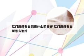 肛门瘙痒有白斑用什么药膏好 肛门瘙痒有白斑怎么治疗