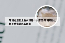 军训过后脸上有白斑是什么原因 军训后脸上起小疙瘩是怎么回事