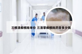 三根清癣根除单价 三清草癣根除药膏多少钱