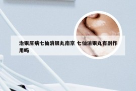 治银屑病七仙消银丸南京 七仙消银丸有副作用吗