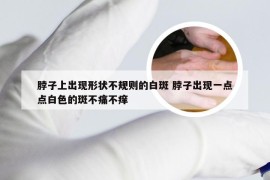 脖子上出现形状不规则的白斑 脖子出现一点点白色的斑不痛不痒