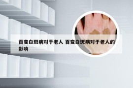 百变白斑病对于老人 百变白斑病对于老人的影响