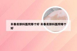 长春皮肤科医院那个好 长春皮肤科医院哪个好