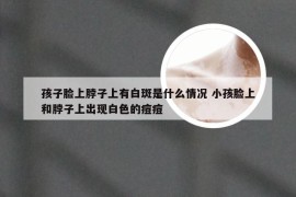 孩子脸上脖子上有白斑是什么情况 小孩脸上和脖子上出现白色的痘痘