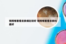 铜陵哪里看皮肤病比较好 铜陵哪里看皮肤科最好