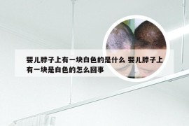 婴儿脖子上有一块白色的是什么 婴儿脖子上有一块是白色的怎么回事