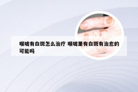 喉咙有白斑怎么治疗 喉咙里有白斑有治愈的可能吗