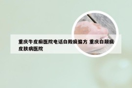 重庆牛皮癣医院电话白殿疯偏方 重庆白颠疯皮肤病医院