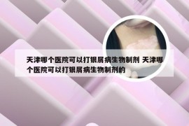 天津哪个医院可以打银屑病生物制剂 天津哪个医院可以打银屑病生物制剂的