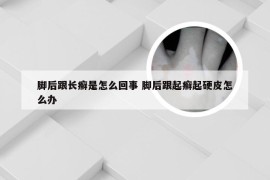 脚后跟长癣是怎么回事 脚后跟起癣起硬皮怎么办