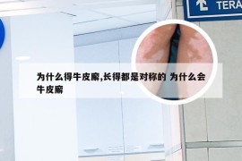 为什么得牛皮廨,长得都是对称的 为什么会牛皮廨