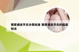 银屑病关节炎分类标准 银屑病关节炎的临床特点