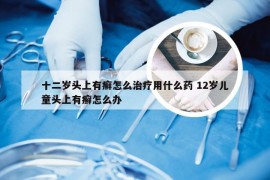 十二岁头上有癣怎么治疗用什么药 12岁儿童头上有癣怎么办